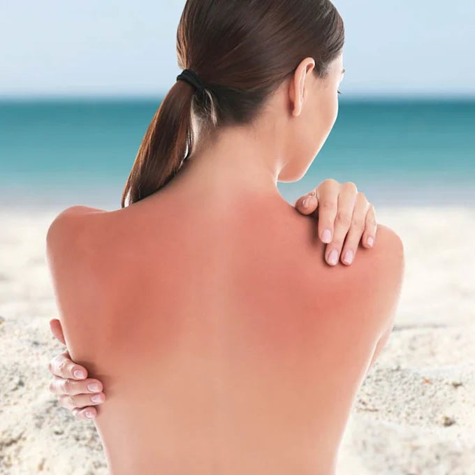 Protectores Solares | La Guía definitiva para cuidar tu piel este verano