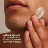 ▶ ISDIN Nutradeica - Gel-crema facial indicado para el tratamiento del exceso de sebo, descamación, picor y eritema de la piel seborreica facial, 50 ml