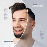 Anacastel Minoxidil Solución 5% | Tratamiento Capilar Anticaída Cabello I Minoxidil Barba y Bigote | Alarga Fase de Crecimiento del Cabello | Hombres y Mujeres | Formato Spray (Azul, 3 Pack)