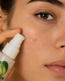 ▶ BÁLSAMO DE BENJUÍ ANTI-ACNÉ  50ML.