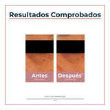 ▶ Eucerin Face Antipigment Crema Contorno de Ojos 15ml : Amazon.com.mx: Belleza