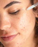 ▶ Ere Perez - Elixir de fito-retinol de té blanco natural, vegano, libre de crueldad, belleza limpia (1 onza líquida | 1.0 fl oz)