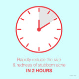 ▶ Neutrogena - Gel para manchas de acné Rapid Clear Stubborn, 1 onza