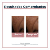 ▶ Eucerin Lápiz corrector anti manchas Anti Pigment Spot Corrector, 5ml