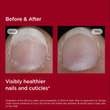 ▶ ISDIN SI-NAILS - Tratamiento de suero para cutículas con ácido hialurónico