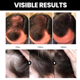 Aceite de batana, aceite de batana orgánico para un cabello sano, promueve el bienestar del cabello para hombres y mujeres, mejora el brillo del cabello y la piel, deja el cabello más suave (1 PCS)