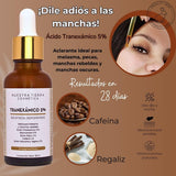 ▶  NUESTAR TIERRA Ácido Tranexámico 5% Para Ojeras, Melasma Y Manchas Rebeldes