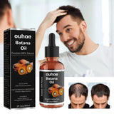Aceite de batana, aceite de batana orgánico para un cabello sano, promueve el bienestar del cabello para hombres y mujeres, mejora el brillo del cabello y la piel, deja el cabello más suave (1 PCS)