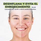 ▶ HEBBE- Hidrolato de Pepino 1 L | Disminuye Arrugas y Ojeras | Alivia Ojos Cansados | Desinflama y Evita Enrojecimiento | Reparador de Daños Solares | Contenido de 1 L