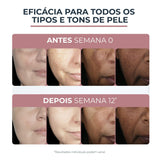 ▶ Eucerin Crema facial hidratante noche anti manchas Anti Pigment, 50ml