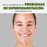 ▶ HEBBE - Aceite de Neem | Mejora, Repara y Protege la Piel | Promueve la Síntesis de Colágeno y Ayuda en el Tratamiento del Acné Inflamatorio | Alivia el Picor de la Varicela | Contenido de 250 ml