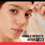 ▶ Neutrogena Parches de espinillas para el acné, tratamiento del acné para la cara, calcomanías de puntos hidrocoloides ultrafinas que proporcionan una curación óptima para espinillas, 24 parches