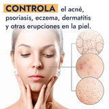 ▶ HEBBE  - ACEITE GRASO VIRGEN DE CALÉNDULA | Protección Rayos UV | Mejora Firmeza de la Piel | Controlador de Acné y Erupciones | 120 ml | Orgánico y Cruelty-Free | Calma la Piel Después de la Exposición Solar