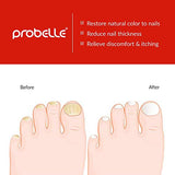 Probelle Tratamiento Natural Liquido Antihongos para Uñas. Restaura el Color y Belleza a Uñas Dañadas por Hongos, Formula Patentada. 0.5 FL OZ | 15 ML
