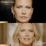 Cicatricure GOLD LIFT, Crema de Día, reduce arrugas gravitacionales, mejora la elasticidad y producción de colágeno, con calcio, silicio, FPS 30 y péptidos con oro, tarro 50 g