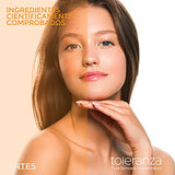 Serum Antimanchas 10% Niacinamida 62% menos Melasma Toleranza Serum Facial Skin Care Dermatológico Dermacosmético - Suero Facial Anti-Pigmento para control de grasa y poros abiertos efecto Despigmentante Facial