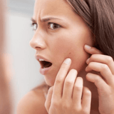 BÁLSAMO DE BENJUÍ ANTI-ACNÉ  30ML.