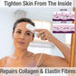 Silk'n Titan - Aparato de cuidado de la piel antienvejecimiento en casa