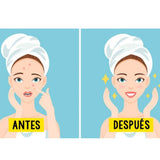 BÁLSAMO DE BENJUÍ ANTI-ACNÉ  30ML.